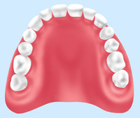 保険診療の入れ歯